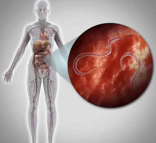 Parásitos no corpo humano