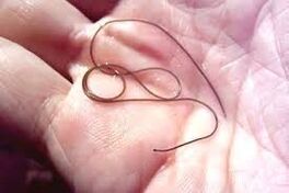 Parasito na palma da túa man