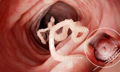 Como recoñecer a presenza de parasitos nos intestinos humanos
