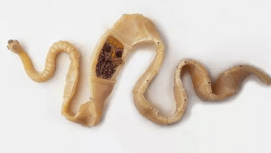 Como descubrir a presenza de parásitos no corpo